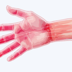 Hand-Arm Vibration Syndrome